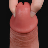 A hand is pulling back the foreskin of an uncircumcised penis.